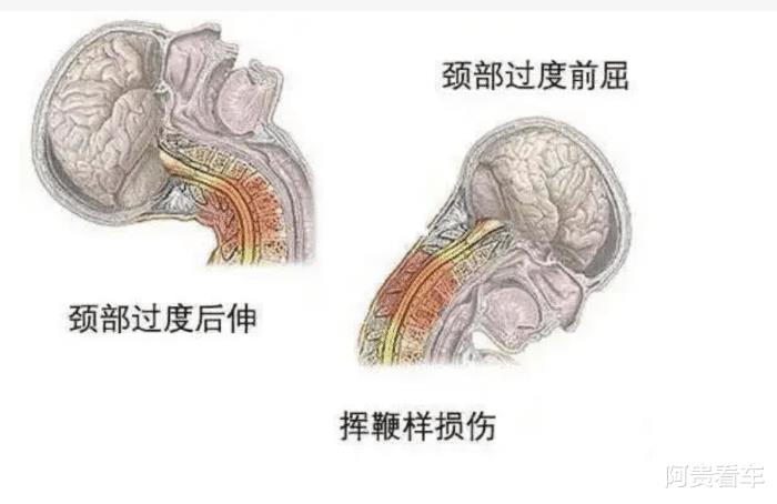 为什么汽车头枕都很不舒服，为什么汽车的头枕都很不舒服-第4张图片