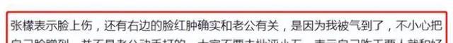 张檬疑似被家暴是真的吗，张檬疑似被家暴是哪一集-第4张图片